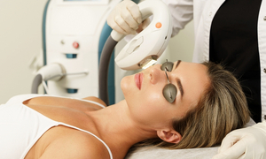 Новинка в УОЦ-«Икша»: IPL‑терапия — путь к идеальной коже!